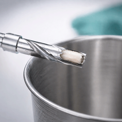 3carotta_apllication_zahnkl